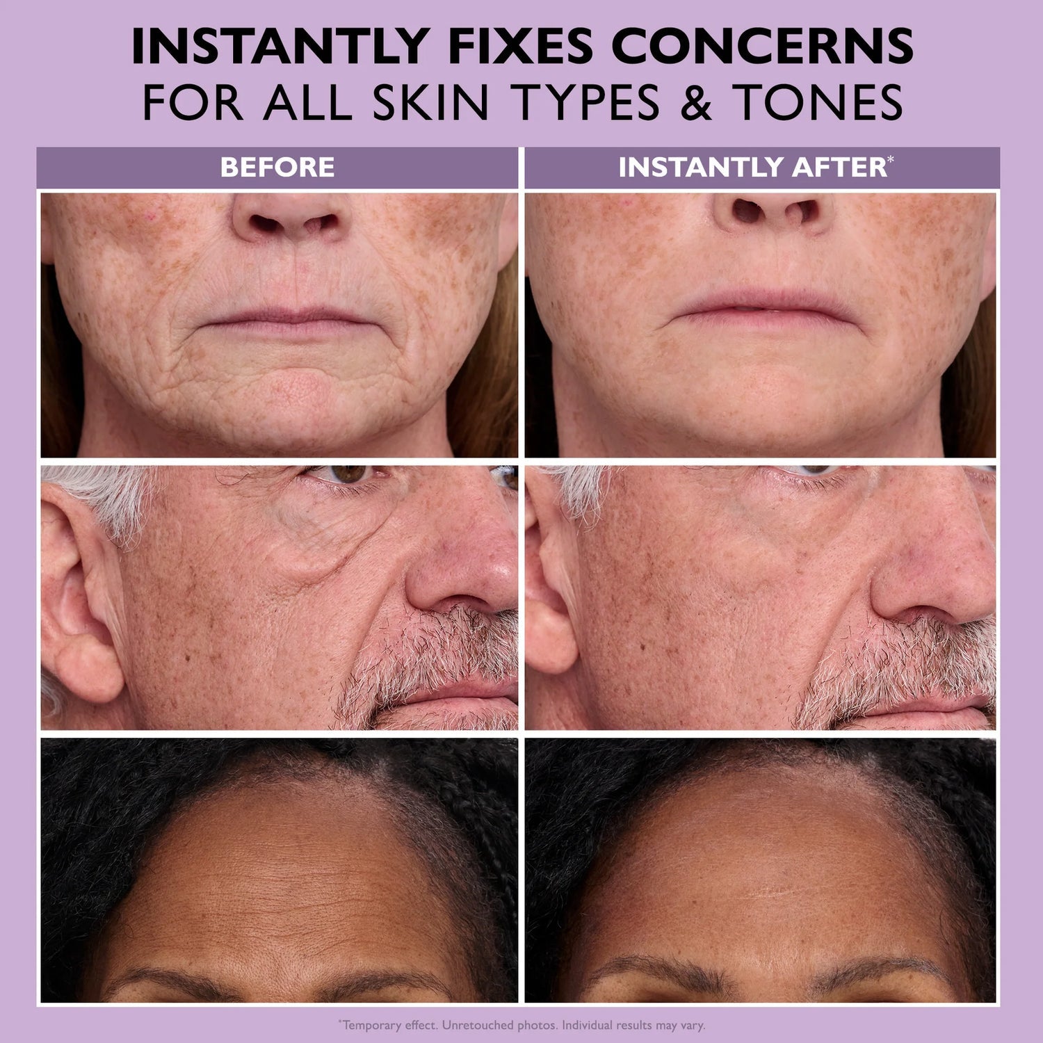Results demonstrated on different skin types and tones