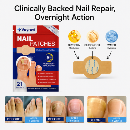 VAYVOVI Fungal Nail Patches